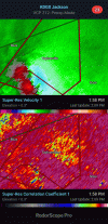 KDGX - Super-Res Velocity 1, 2_07 PM.gif